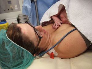 skin to skin C-section